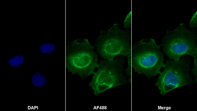 AGTR1 Antibody in Immunocytochemistry (ICC/IF)