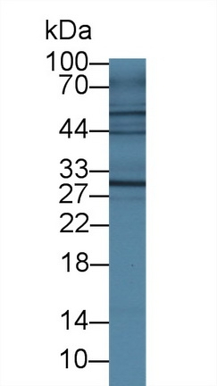 IL4R Antibody in Western Blot (WB)