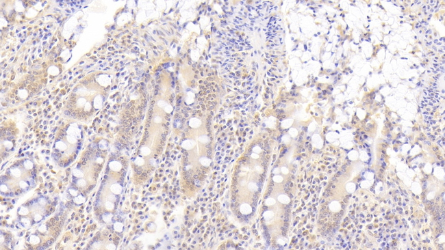 ADAMTS9 Antibody in Immunohistochemistry (Paraffin) (IHC (P))