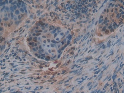 Thrombospondin 1 Antibody in Immunohistochemistry (Paraffin) (IHC (P))