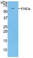 Thrombospondin 4 Antibody in Western Blot (WB)