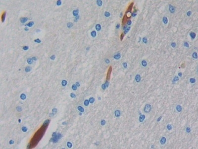 HBM Antibody in Immunohistochemistry (Paraffin) (IHC (P))