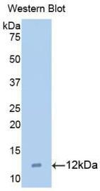 MIP-1 delta Antibody in Western Blot (WB)