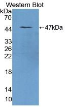 REG1A Antibody in Western Blot (WB)