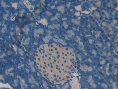 Oncomodulin Antibody in Immunohistochemistry (Paraffin) (IHC (P))