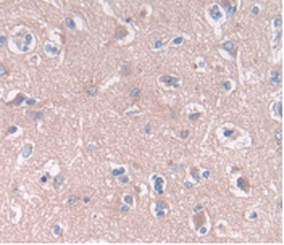 CLEC4C Antibody in Immunohistochemistry (Paraffin) (IHC (P))