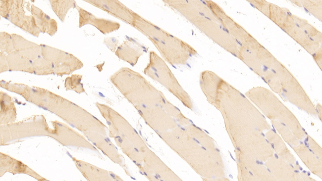 Prostate Specific Acid Phosphatase Antibody in Immunohistochemistry (Paraffin) (IHC (P))