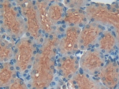 Kininogen Heavy Chain Antibody in Immunohistochemistry (Paraffin) (IHC (P))