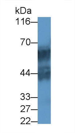 KRT71 Antibody in Western Blot (WB)