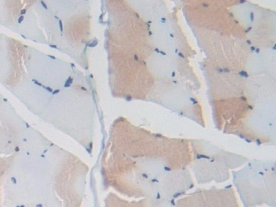 GARP Antibody in Immunohistochemistry (Paraffin) (IHC (P))