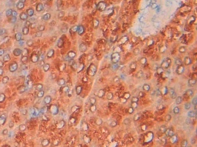 PGP Antibody in Immunohistochemistry (Paraffin) (IHC (P))