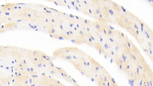EpoR Antibody in Immunohistochemistry (Paraffin) (IHC (P))