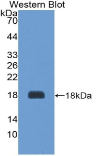 AgRP Antibody in Western Blot (WB)