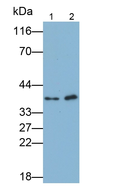 WT1 Antibody in Western Blot (WB)