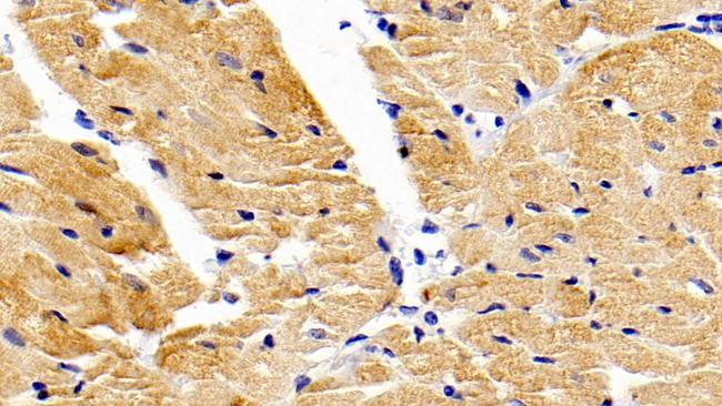 MMP9 Antibody in Immunohistochemistry (Paraffin) (IHC (P))
