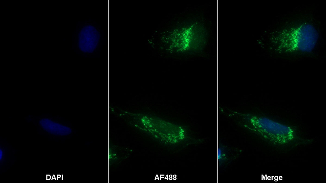 TACR2 Antibody in Immunocytochemistry (ICC/IF)