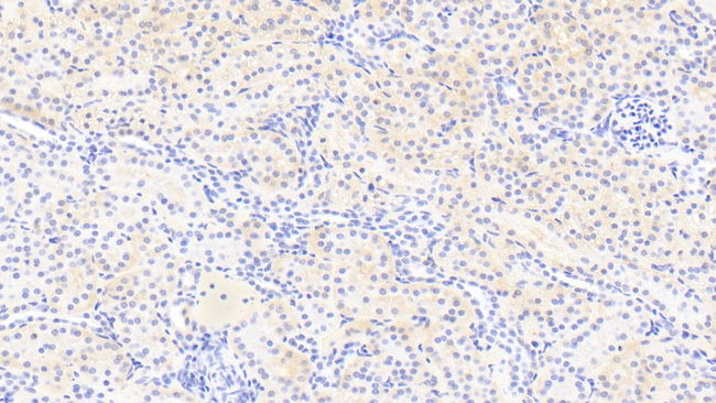 C13orf15 Antibody in Immunohistochemistry (Paraffin) (IHC (P))