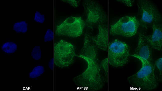 CD138 Antibody in Immunocytochemistry (ICC/IF)