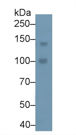 PLCB4 Antibody in Western Blot (WB)