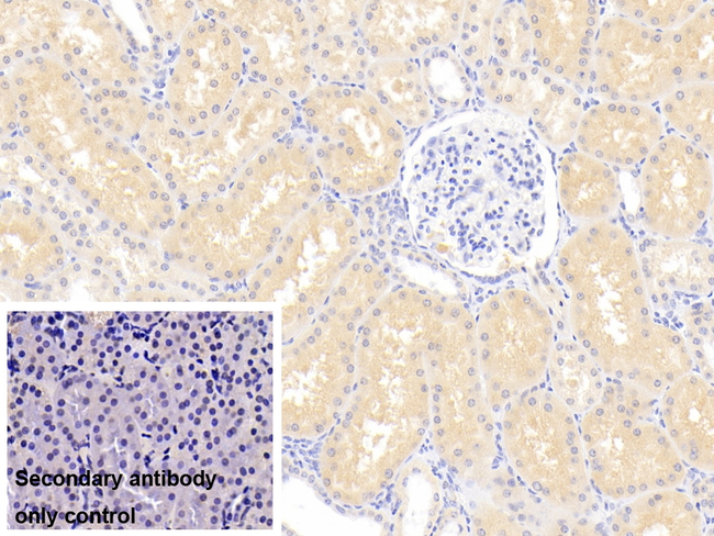 LCN12 Antibody in Immunohistochemistry (Paraffin) (IHC (P))