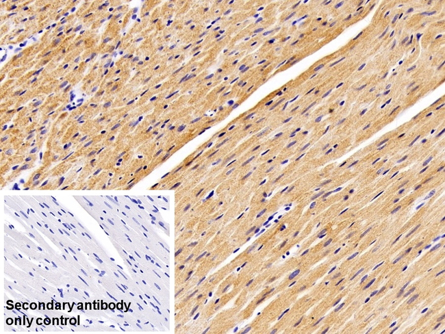 VDAC Antibody in Immunohistochemistry (Paraffin) (IHC (P))