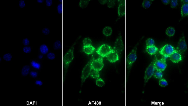 IL-12 p35 Antibody in Immunocytochemistry (ICC/IF)