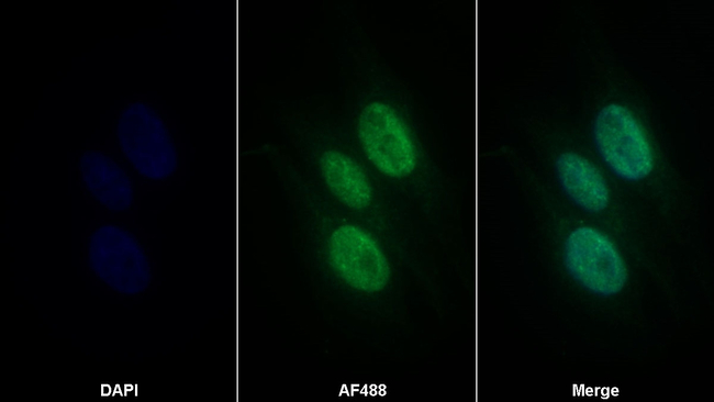 S100A1 Antibody in Immunocytochemistry (ICC/IF)