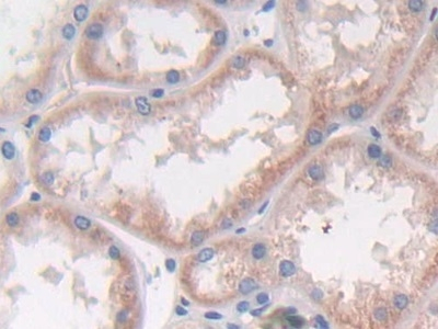 Interferon alpha-2 Antibody in Immunohistochemistry (Paraffin) (IHC (P))