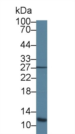 ACYP1 Antibody in Western Blot (WB)