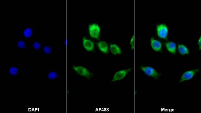 M-CSF Antibody in Immunocytochemistry (ICC/IF)