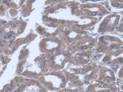 VARS Antibody in Immunohistochemistry (Paraffin) (IHC (P))