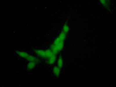 SGSH Antibody in Immunocytochemistry (ICC/IF)
