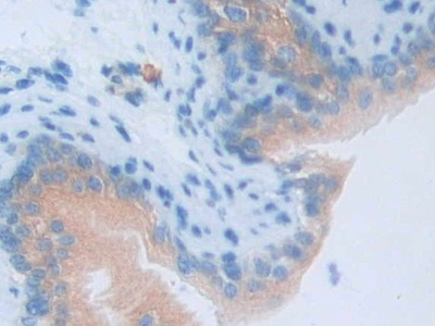 LCN5 Antibody in Immunohistochemistry (Paraffin) (IHC (P))