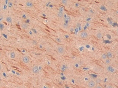 MEPE Antibody in Immunohistochemistry (Paraffin) (IHC (P))
