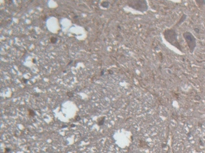 GLRA2 Antibody in Immunohistochemistry (Paraffin) (IHC (P))