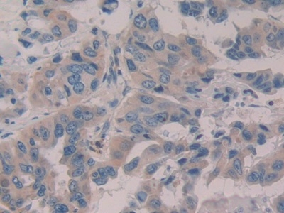 WISP1 Antibody in Immunohistochemistry (Paraffin) (IHC (P))