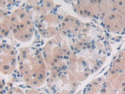 PAFAH2 Antibody in Immunohistochemistry (Paraffin) (IHC (P))