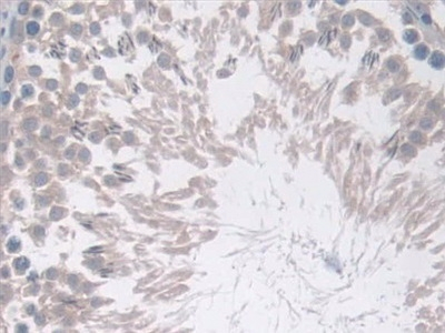 COX1 Antibody in Immunohistochemistry (Paraffin) (IHC (P))