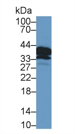 POMC Antibody in Western Blot (WB)