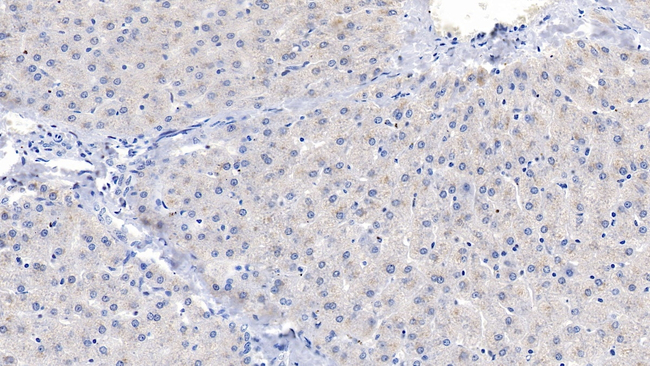 PLCD3 Antibody in Immunohistochemistry (Paraffin) (IHC (P))