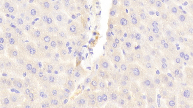 MRP6 Antibody in Immunohistochemistry (Paraffin) (IHC (P))
