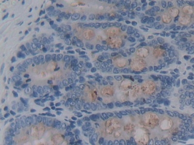REG3B Antibody in Immunohistochemistry (Paraffin) (IHC (P))