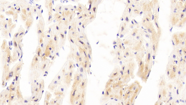 P4HA3 Antibody in Immunohistochemistry (Paraffin) (IHC (P))