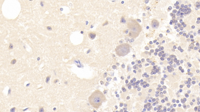 TUBA3C Antibody in Immunohistochemistry (Paraffin) (IHC (P))
