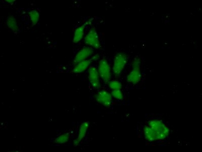 YARS Antibody in Immunocytochemistry (ICC/IF)