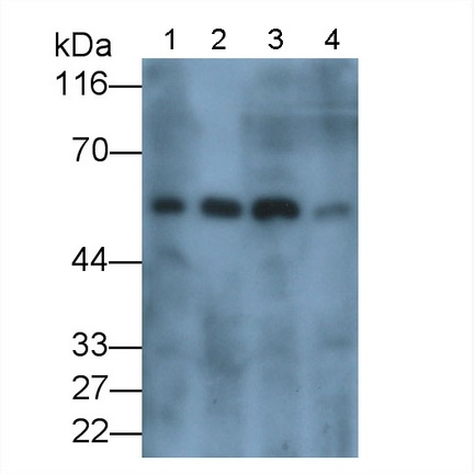 Carbonic Anhydrase IX Antibody in Western Blot (WB)