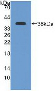 ATR Antibody in Western Blot (WB)