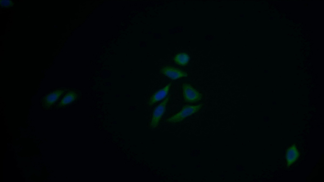 ACAT1 Antibody in Immunocytochemistry (ICC/IF)
