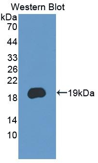 PCDH20 Antibody in Western Blot (WB)