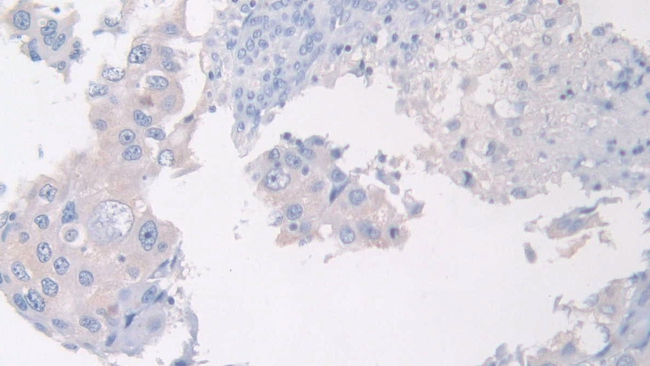 PANK4 Antibody in Immunohistochemistry (Paraffin) (IHC (P))